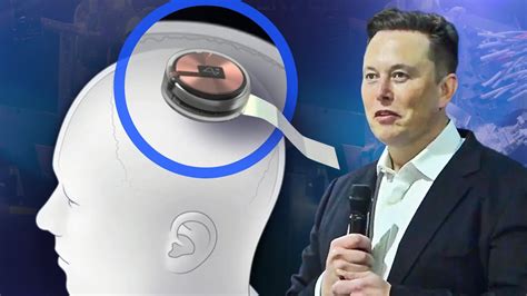 rfid chip implant 2023|Elon Musk's Neuralink Has Implanted Its First Chip in .